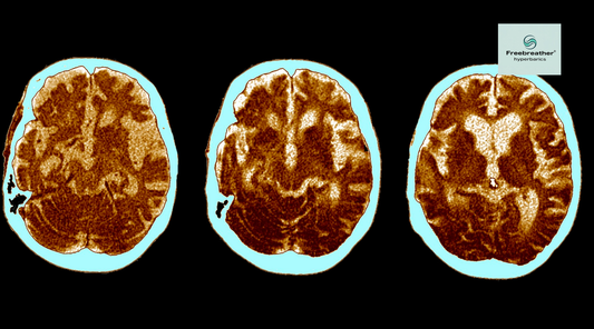 Why HBOT Can Be Effective for Neurodegenerative Diseases